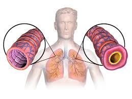 Allergic & Bronchial Asthma